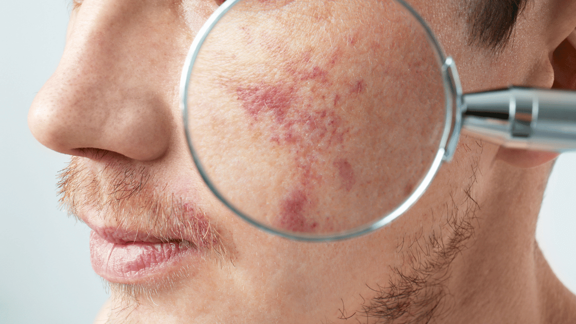 Dermatologia
